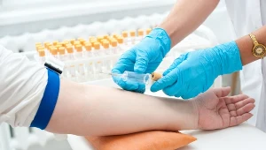 Na 30 minut przed pobraniem krwi zaleca się wypicie szklanki wody. Dlaczego? O czym trzeba pamiętać? Odpowiadamy