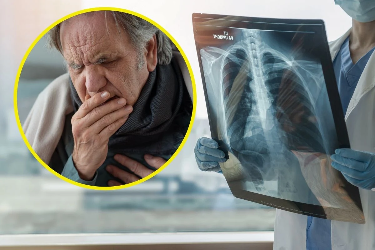 Kaszel palacza, nawet po porzuceniu nałogu, może utrzymywać się kilka miesięcy Kaszel palacza, nawet po porzuceniu nałogu, może utrzymywać się kilka miesięcy