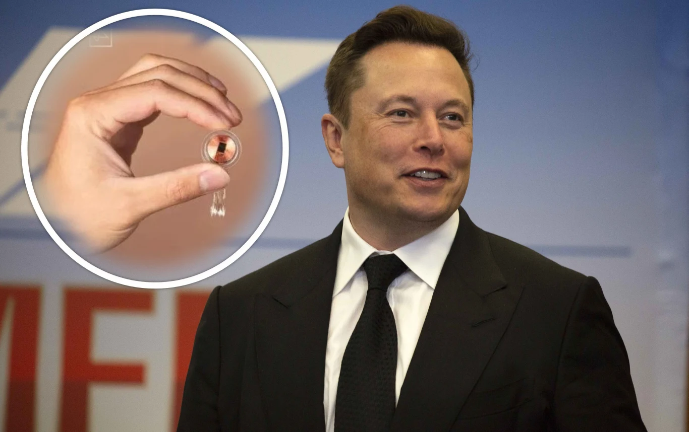 Elon Musk ogłasza sukces. Pierwszy pacjent po wszczepieniu implantu Neuralink Elon Musk ogłasza sukces. Pierwszy pacjent po wszczepieniu implantu Neuralink