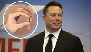 Elon Musk to zrobił. Implant Neuralink w mózgu pierwszego pacjenta