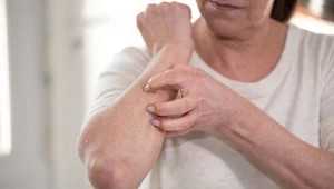 Dlaczego swędzi? Tak dają o sobie znać szwankujące narządy