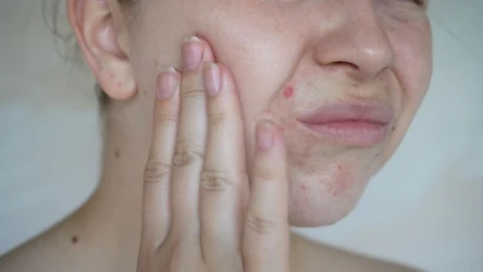 Zbyt rzadkie mycie gąbeczki do makijażu może pogorszyć stan cery 