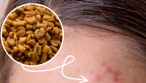 Ta roślina jest znana od wieków. Pomaga leczyć trądzik i nadaje skórze blasku