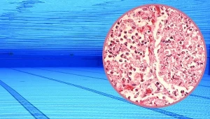 W wodzie na basenie w Krotoszynie wykryto bakterie legionelli