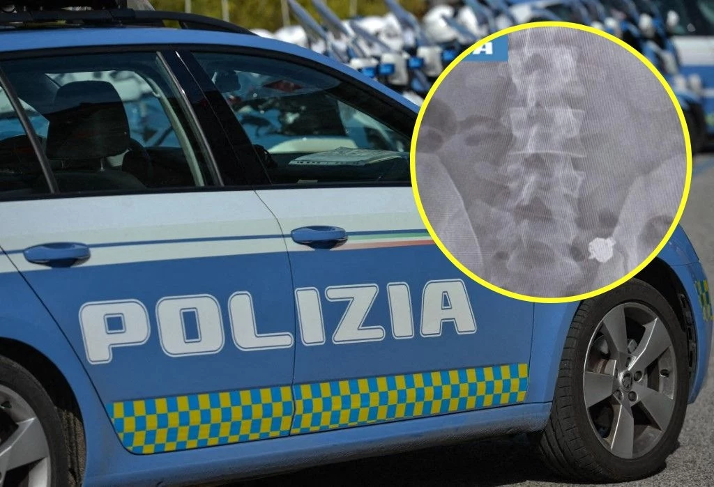 Policja zabrała mężczyznę na pogotowię, by zrobić prześwietlenie Policja zabrała mężczyznę na pogotowię, by zrobić prześwietlenie
