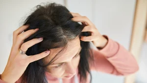 Dlaczego włosy wypadają garściami? Winne mogą być nasze codzienne nawyki, choroba czy wzmożony stres