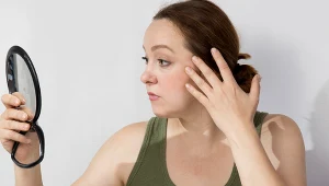 Tycie w okolicach twarzy może być objawem choroby