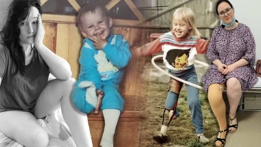 Iwona choruje na tibial hemimeli, ale czerpie z życia pełnymi garściami 