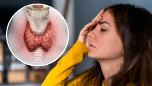 Niedoczynność tarczycy i Hashimoto to nie to samo. Kluczowe kilka objawów