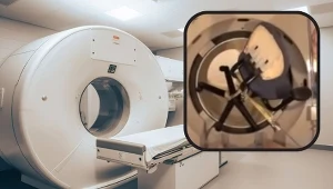 Siła przyciągania rezonansu jest bardzo duża, dlatego metalowe przedmioty w ciele są przeciwwskazaniem do badania/ fot. rezonansu, który przyciągnął krzesło YouTube/Rafał Jackiewicz