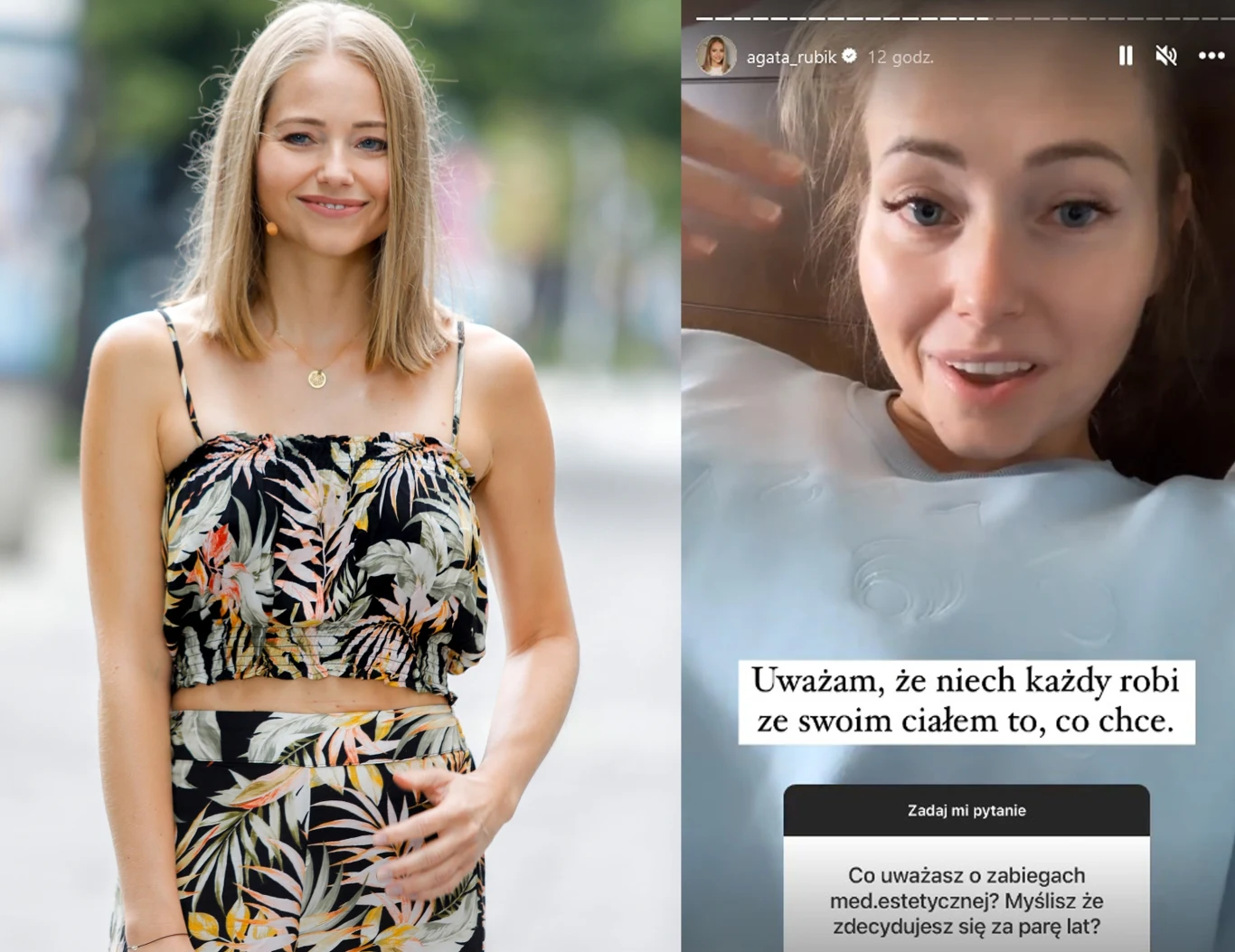 Agata Rubik o korzystaniu z medycyny estetycznej