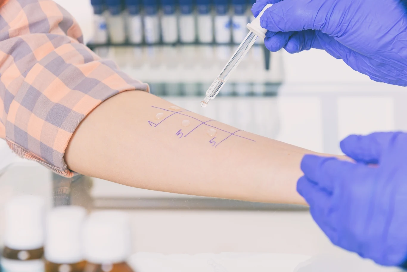 Decyzję o rozpoczęciu odczulania podejmuje się po wywiadzie i przeprowadzeniu testów alergicznych Decyzję o rozpoczęciu odczulania podejmuje się po wywiadzie i przeprowadzeniu testów alergicznych