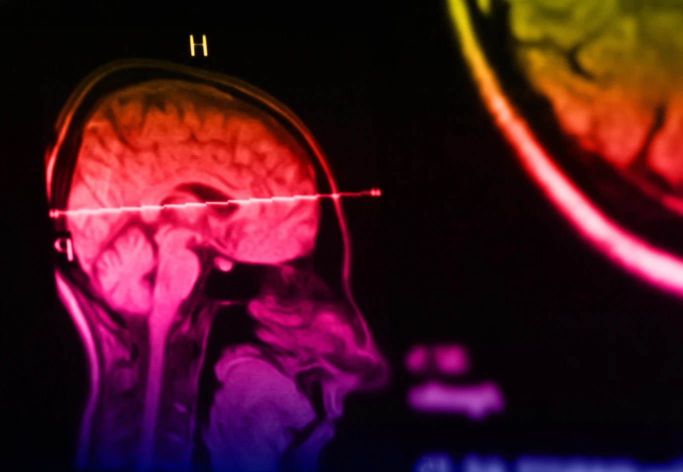 Urządzenie będzie w stanie zdiagnozować uraz przez gałkę oczną za pomocą wiązki lasera Urządzenie będzie w stanie zdiagnozować uraz przez gałkę oczną za pomocą wiązki lasera