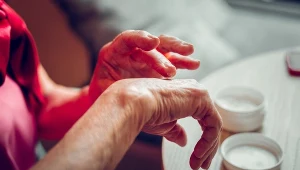 Skóra wymaga ciągłego nawilżania? Natychmiast zbadaj krew i nerki