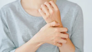 Choć świąd kojarzy się zwykle z chorobami skóry, może oznaczać również inne schorzenia