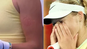 Mirra Andriejewa ugryzła się w rękę - screen: Eurosport