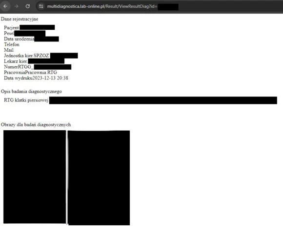 Luki w systemie stosowanym przez Multidiagnostica pozwalały podejrzeć dane pacjentów, w tym numery PESEL.