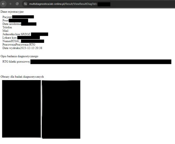 Luki w systemie stosowanym przez Multidiagnostica pozwalały podejrzeć dane pacjentów, w tym numery PESEL. Luki w systemie stosowanym przez Multidiagnostica pozwalały podejrzeć dane pacjentów, w tym numery PESEL.
