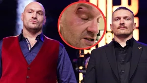 Tyson Fury i jego rozcięcie na oku, obok Ołeksandr Usyk
