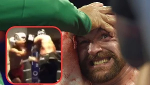 Tyson Fury nabawił się kontuzji w sparingu (mały kadr), która wyklucza go z wielkiego, unifikacyjnego starcia z Ołeksandrem Usykiem