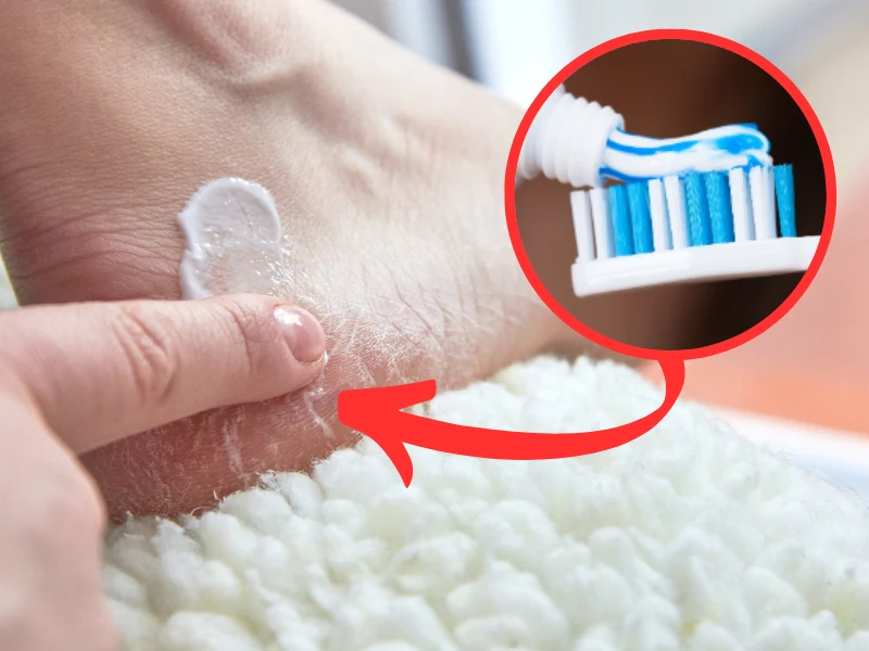 Domowa "pasta do zębów" pomoże ci wygładzić stopy bez wydawania pieniędzy na zabiegi w salonach kosmetycznych Domowa "pasta do zębów" pomoże ci wygładzić stopy bez wydawania pieniędzy na zabiegi w salonach kosmetycznych