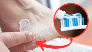 Zamiast zębów, natrzyj tym suche i popękane pięty. Twoje stopy będą gładkie jak jedwab