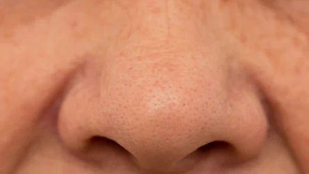 Wygładź pory delikatnym serum z kwasem mlekowym i odzyskaj gładką cerę