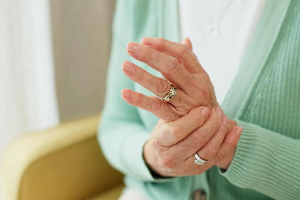 Łuszczycowe zapalenie skóry objawami przypomina zmiany zwyrodnieniowe albo kontuzję Łuszczycowe zapalenie skóry objawami przypomina zmiany zwyrodnieniowe albo kontuzję