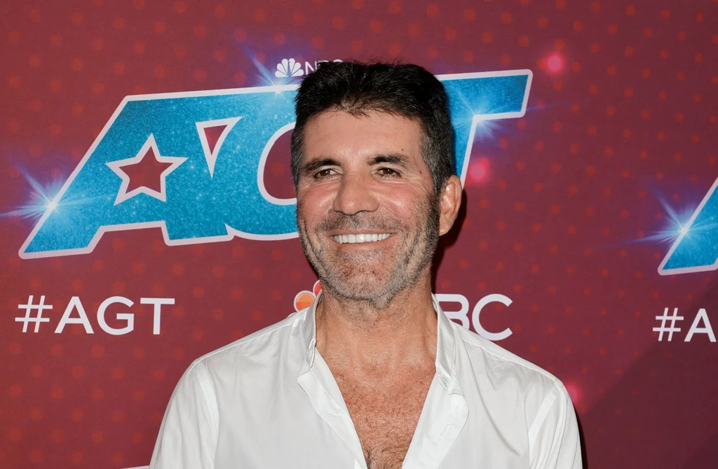 Simon Cowell przed usunięciem botoksu