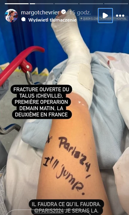 Kontuzjowana noga Margot Chevrier