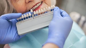 Czy można wybielić zęby domowymi sposobami? Tak, ale wszelkie metody należy stosować ostrożnie