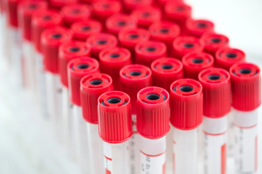 Przed niektórymi badaniami wykonywanymi z krwi, należy bezwzględnie pozostać na czczo przez kilkanaście godzin Przed niektórymi badaniami wykonywanymi z krwi, należy bezwzględnie pozostać na czczo przez kilkanaście godzin