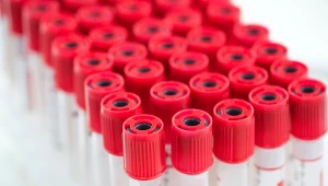 Robisz to przed badaniem krwi? Wyniki mogą wyjść niewiarygodne