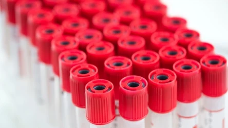 Przygotowanie do badań krwi zaczyna się dużo wcześniej niż w laboratorium