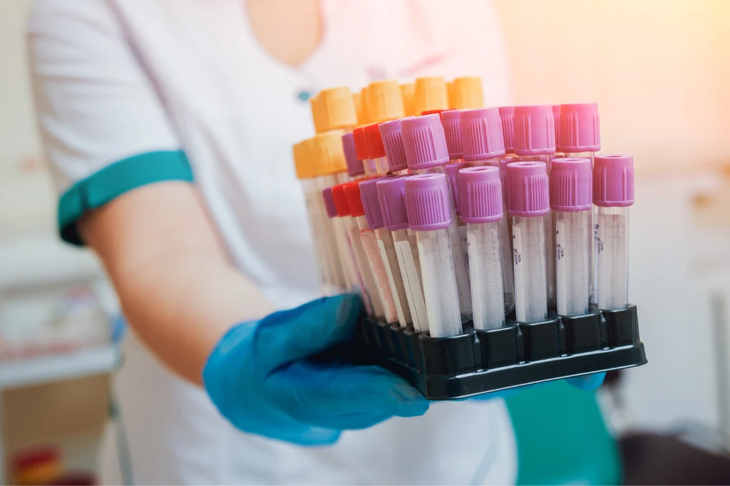 Morfologia, cukier, TSH, lipidy nie wyjdą poprawnie. Nie rób tego przed badaniami