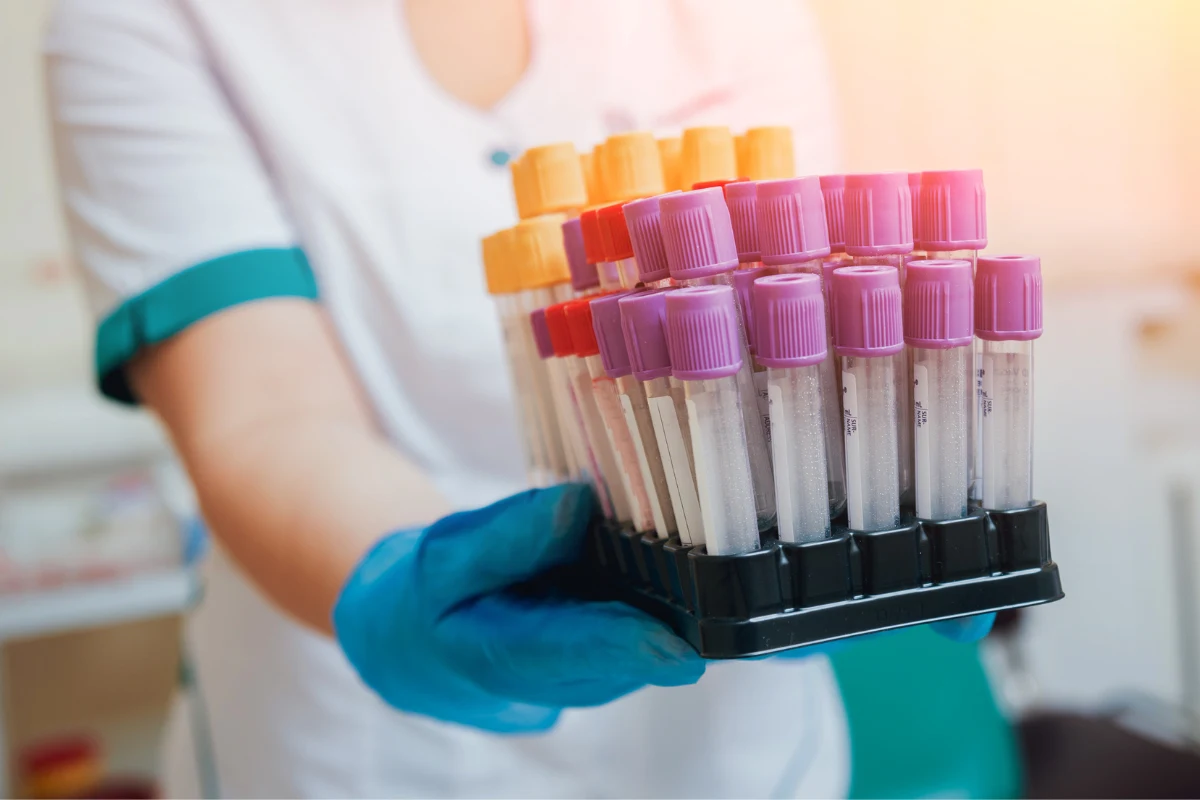 RDW-CV to badanie wchodzące w skład morfologii, które określa zmienność objętości czerwonych krwinek RDW-CV to badanie wchodzące w skład morfologii, które określa zmienność objętości czerwonych krwinek