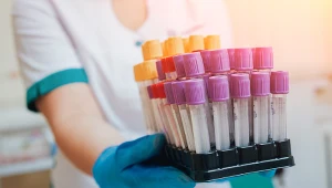 Rób minimum raz w roku. Pomoże przewidzieć raka, anemię i choroby nerek