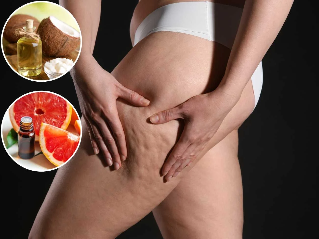 Jak pozbyć się cellulitu? Stosuj regularnie te produkty. Jak pozbyć się cellulitu? Stosuj regularnie te produkty.