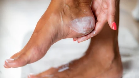 Maść z witaminą A to tanie i skuteczne rozwiązanie na suche i popękane pięty zimą.