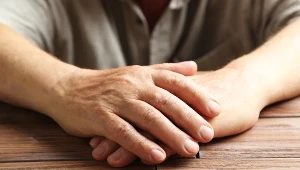 Chora wątroba wysyła sygnały przez skórę. Zwróć uwagę na dłonie