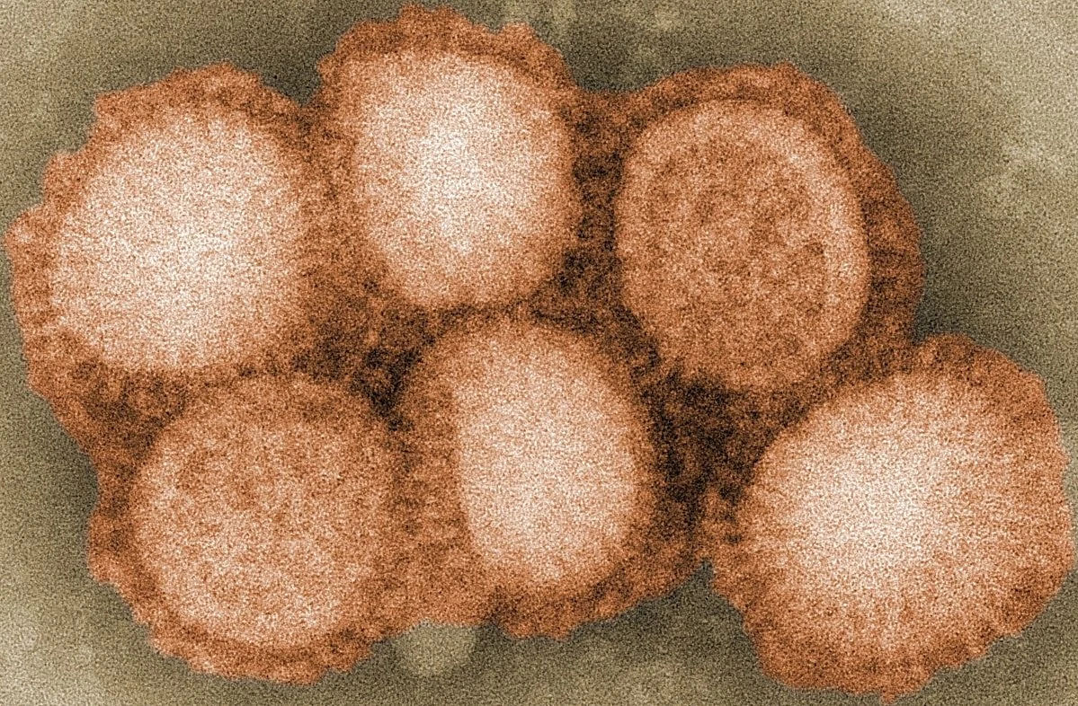 Tak wygląda wirus H5N2