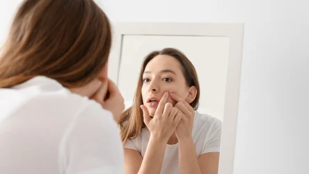 Błędy pielęgnacyjne popełniane latem, mogą przyczyniać się do powstawania niedoskonałości na skórze