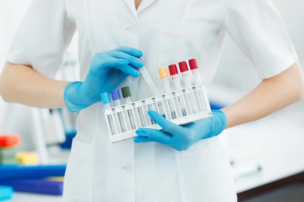 Glukoza, mierzona w próbce pobranej na czczo, powinna mieścić się w przedziale 70-100 mg/dl