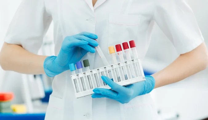 Glukoza, mierzona w próbce pobranej na czczo, powinna mieścić się w przedziale 70-100 mg/dl