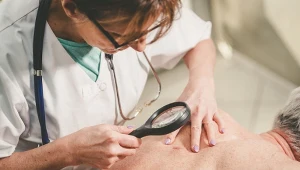 Kojarzysz czerwone znamiona na skórze? To sygnał alarmowy z wątroby