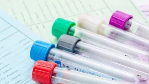 Powszechnie znane są cztery grupy krwi, jednak jest ich o wiele więcej