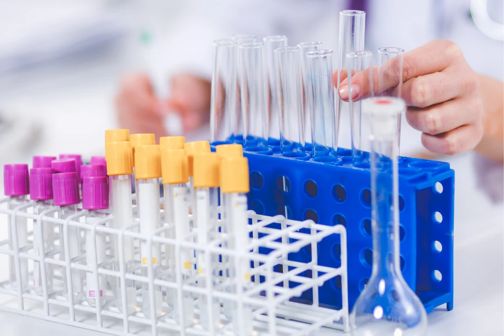 Wysoki poziom bilirubiny u noworodków prowadzi do żółtaczki poporodowej