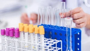 Przetoczenie nieprawidłowej grupy krwi grozi odczynem przetoczeniowym, który bezpośrednio zagraża życiu pacjenta