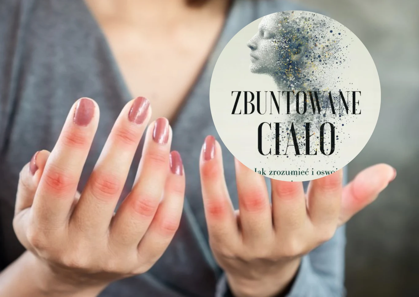 Choroba niszczy im życie. „My mamy chore stawy, a Polska chory system opieki zdrowotnej” 