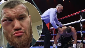 Arslanbek Machmudow  pokazał, jak wygląda po przerwanej walce